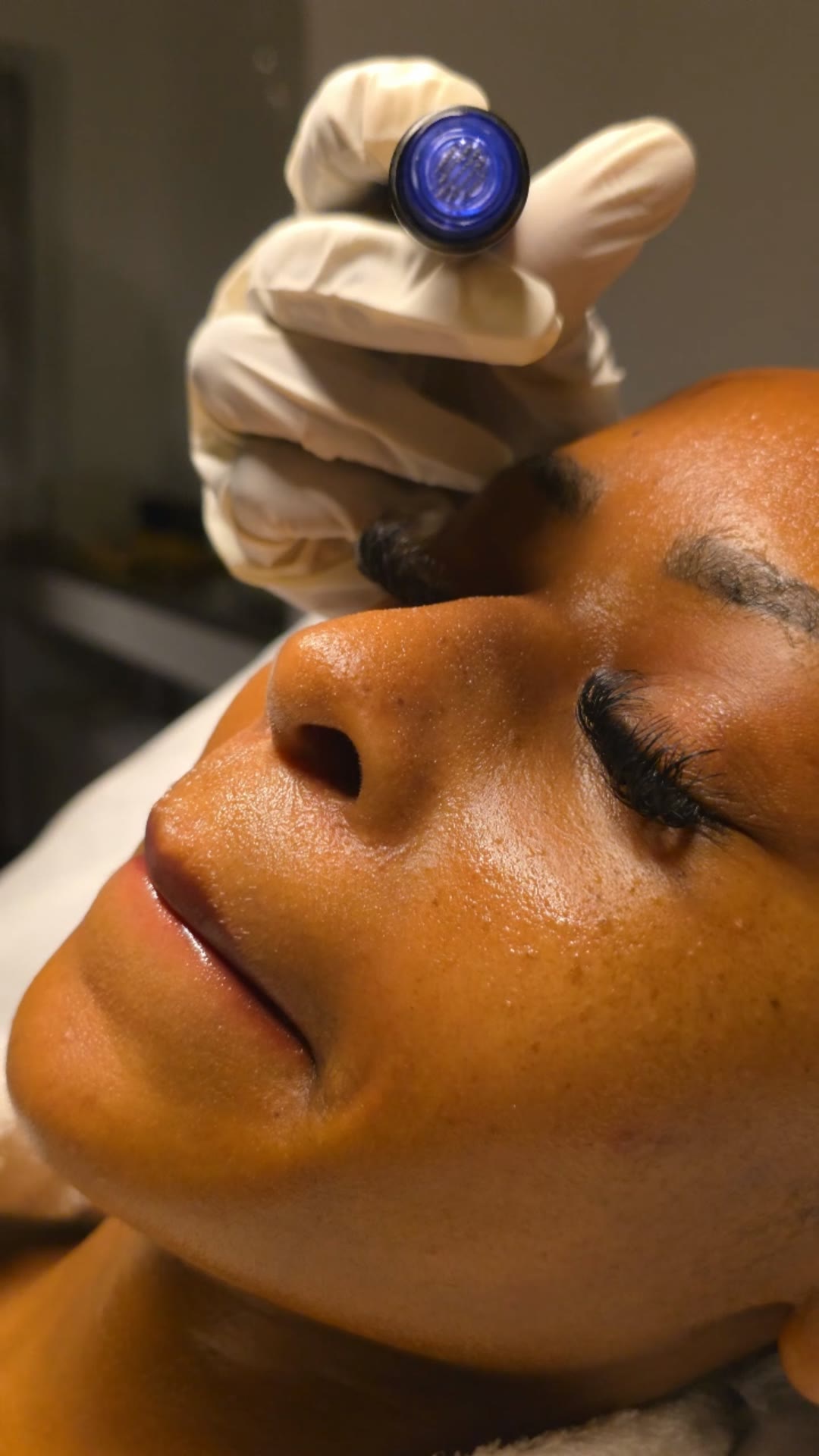 HydraFacial handpiece cleansing a client’s forehead during a medical facial at Melton
