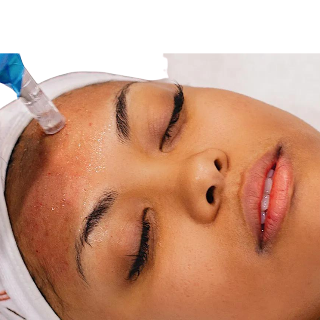 IV Glutathione and vitamins